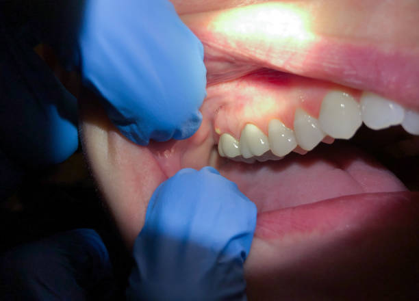 Best Teeth Whitening  in Wichita Falls, TX